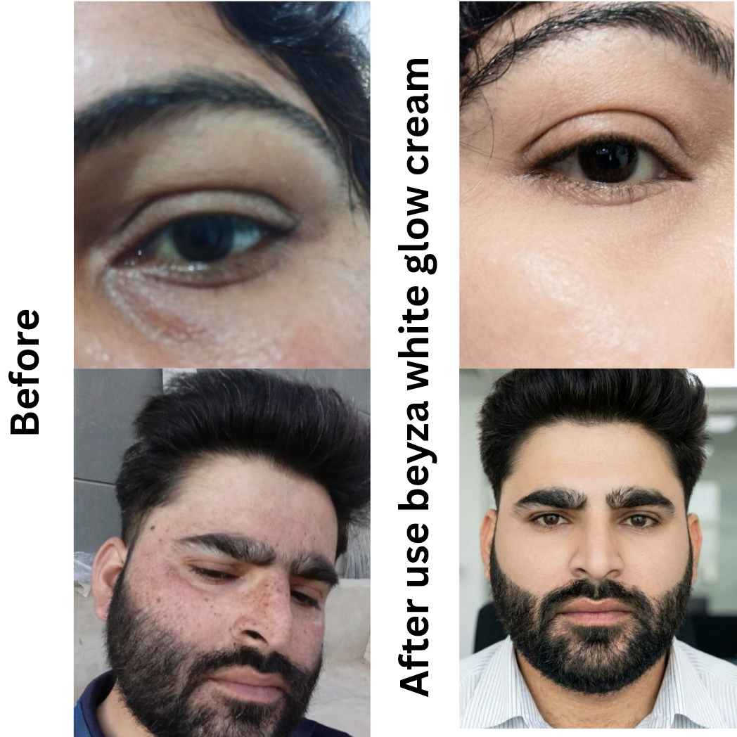 Beyza white glow face cream whitening and brightening (All skin types)